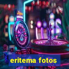 eritema fotos